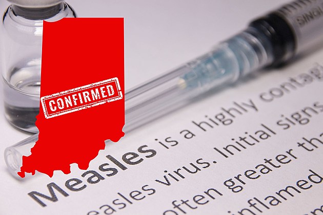attachment-Measles Outbreak Indiana